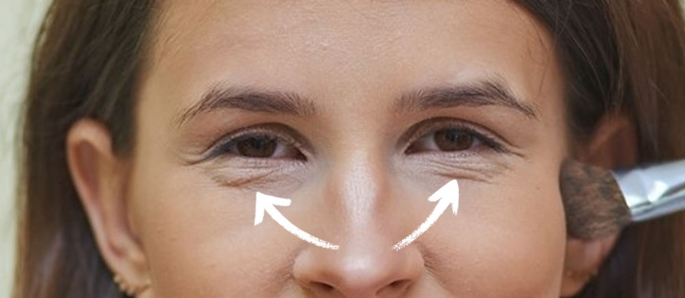 Инъекции вокруг глаз от мешков под глазами