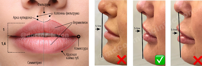 Между носом и ртом. Колонна фильтрума верхней губы. Формы губ.