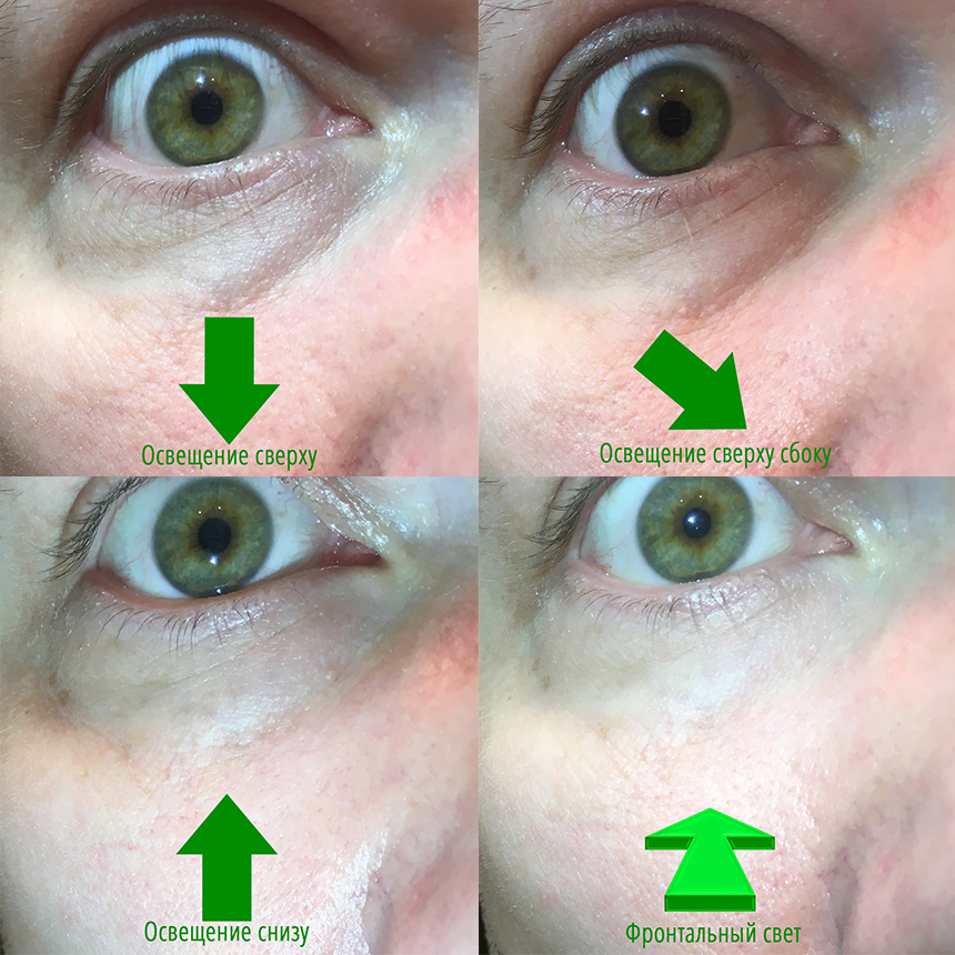 Красные круги перед глазами - симптомы какой болезни — Клиника «Доктор рядом»